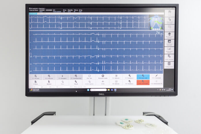 Prevenzione cardiovascolare